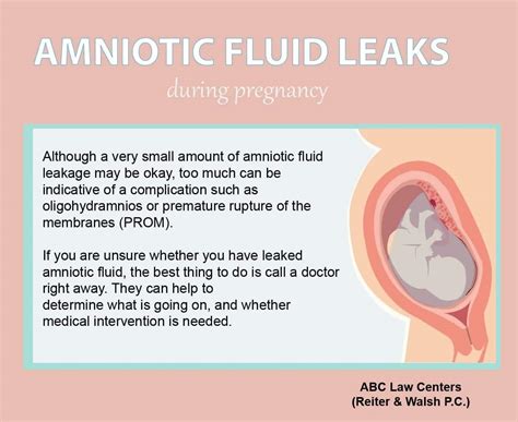 how do you know if your leaking amniotic fluid|3 Ways to Identify an Amniotic Fluid Leak